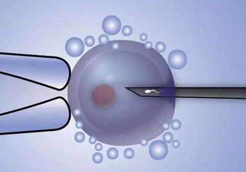 精子畸形有去博鳌试管三代成功的嘛？